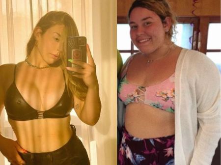 Jesaaelys Ayala González before & after surgery.